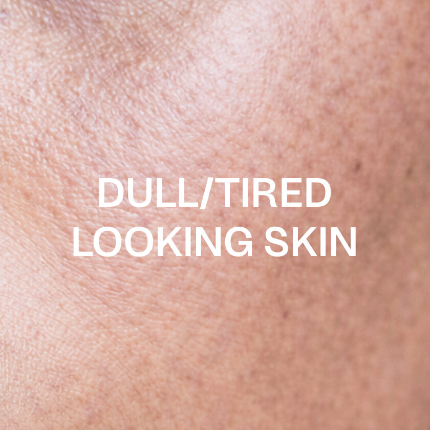 Vermoeide of doffe huid