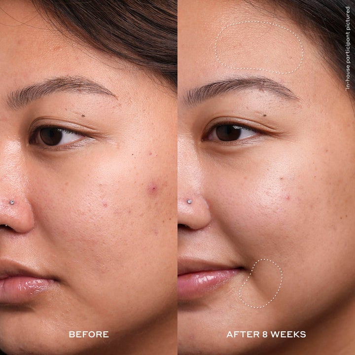 Detox & Glow - Avgiftande och Lystergivande Behandling för Män med Trött Hy
