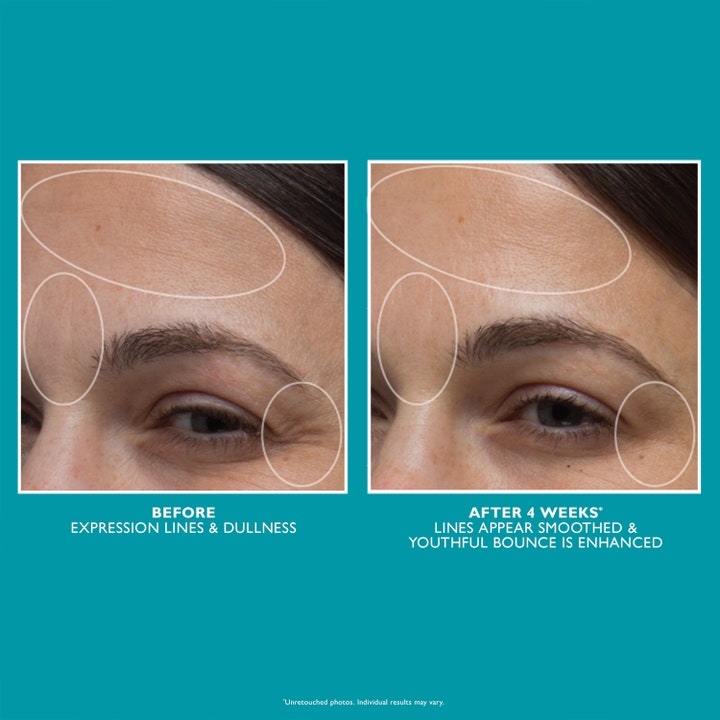 Peptide Skinjection™ Moisture Infusion Cream