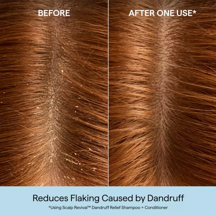 Scalp Revival™ Dandruff Relief Shampoo