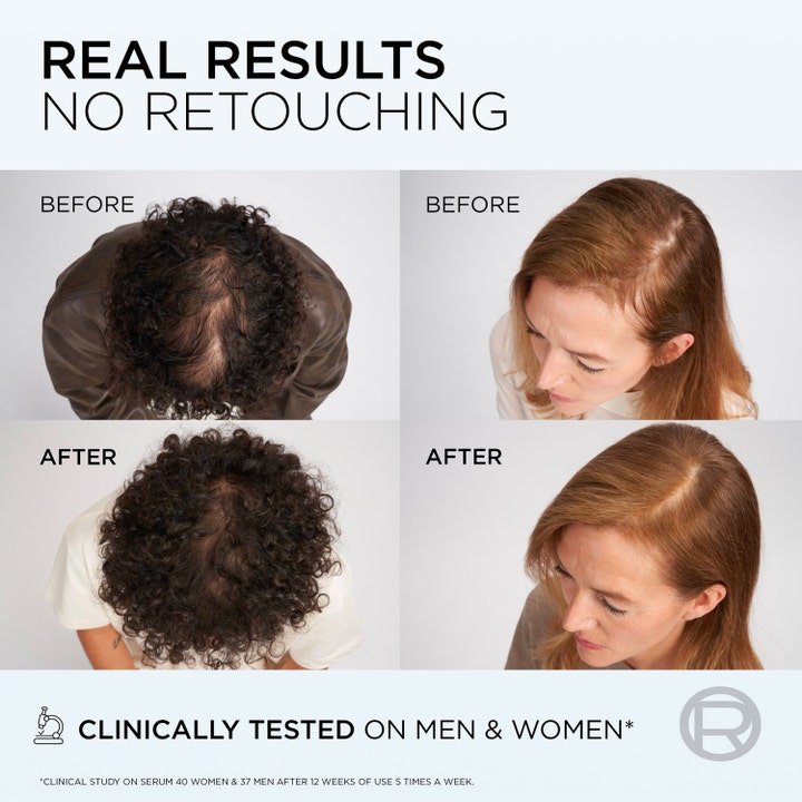 Elvital Growth Booster Shampoo