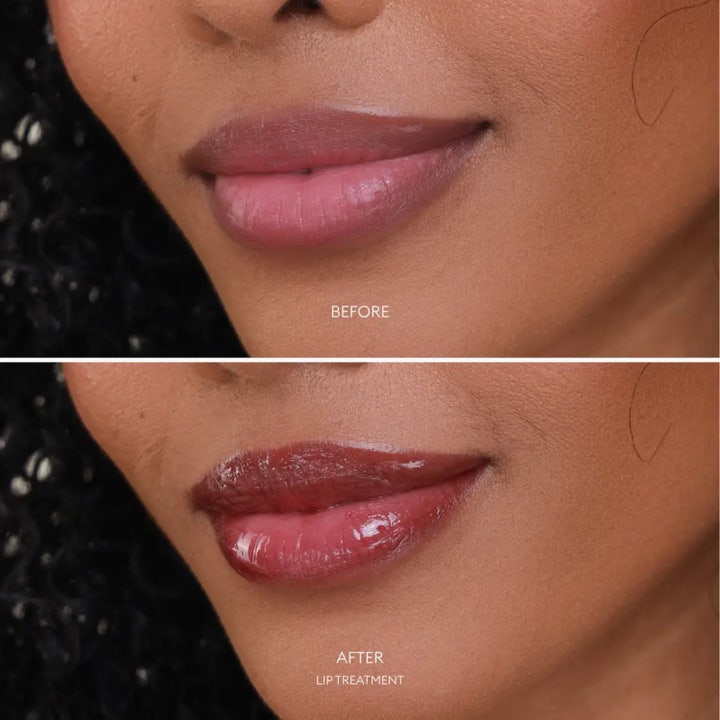 Lip Treatment Hydrating Balm